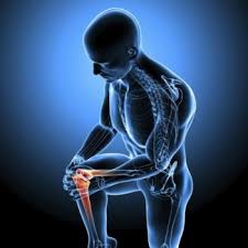 Jak si vybrat kolenní polštář v případě artrózy kolenního kloubu - odborné rady