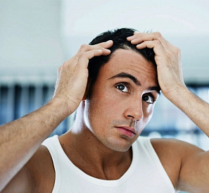 10 bästa lösningar för skallighet (alopeci)